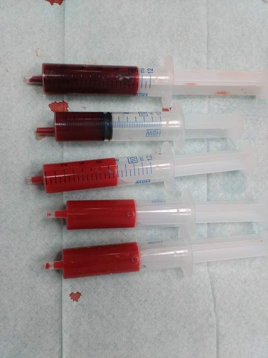 Blood: Body fluid in the circulatory system